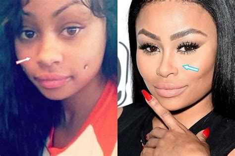 blac chyna before and after fame|Blac Chyna Compares Old Photos Before Removing。